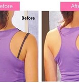 Merkloos BH Clips – BH Clip Achterkant – BH Bandjes Tegen Afzakkende – Set van 12