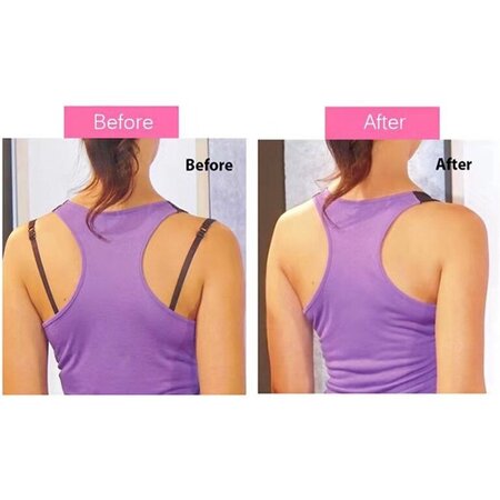 Merkloos BH Clips – BH Clip Achterkant – BH Bandjes Tegen Afzakkende – Set van 12