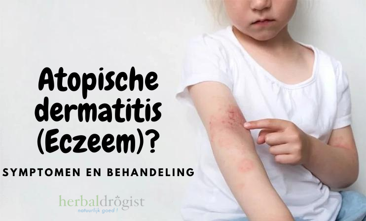 Wat is atopische dermatitis (Eczeem)? Symptomen en behandeling  