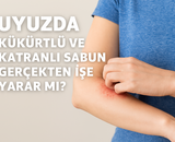 Uyuz Kimlere Bulaşmaz, Uyuz Hastalık mı, İlacı Var mı, Evde Tedavi Mümkün mü? Uyuz Hakkında Bilmedikleriniz: 