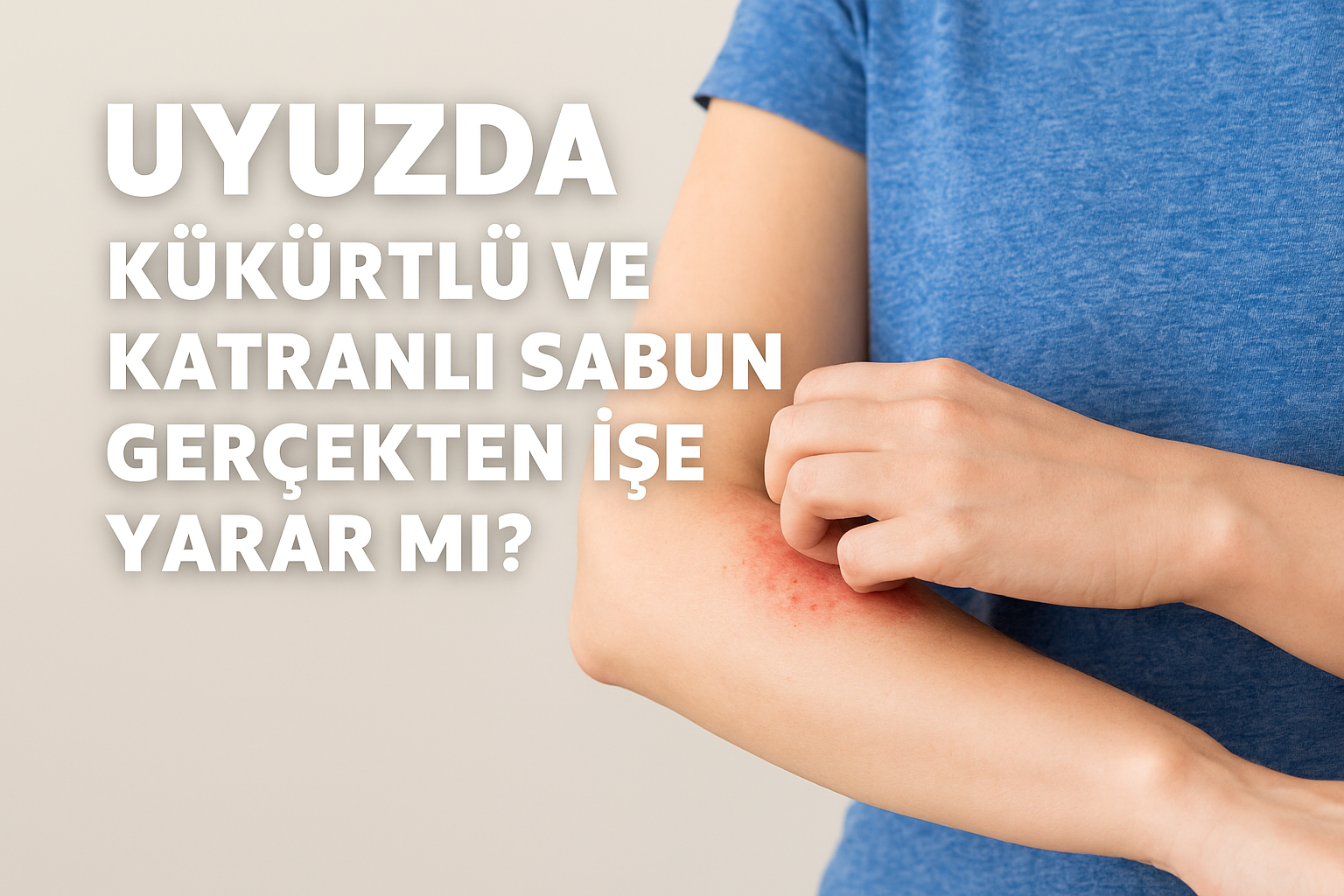 Uyuz Kimlere Bulaşmaz, Uyuz Hastalık mı, İlacı Var mı, Evde Tedavi Mümkün mü? Uyuz Hakkında Bilmedikleriniz: 