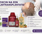 Bioxcin na een haartransplantatie: Mag je het gebruiken? Welke producten zijn geschikt en wanneer?
