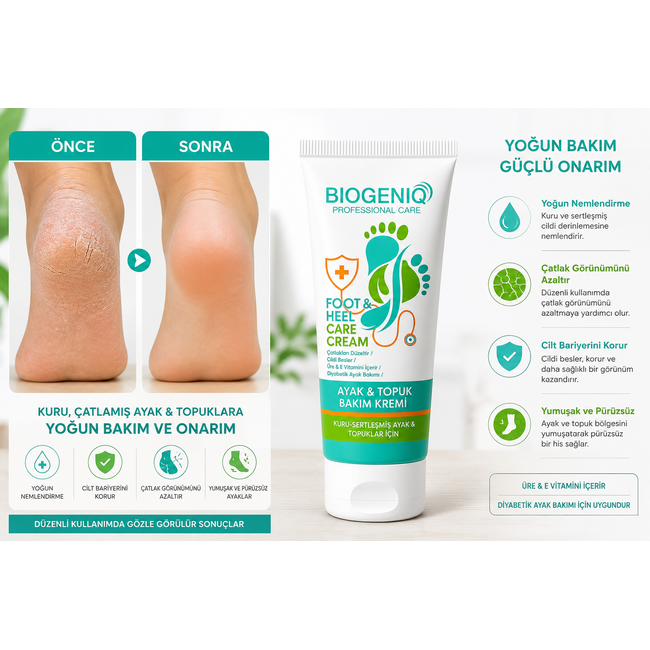 Biogeniq Crème Pieds & Talons 50 ml – Pour Talons Secs, Gerçures & Callosités | À l’Urée & Allantoïne