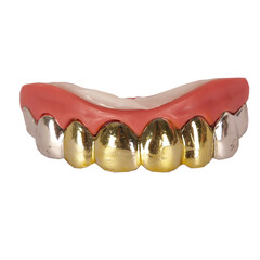 Tanden Goud/zilver