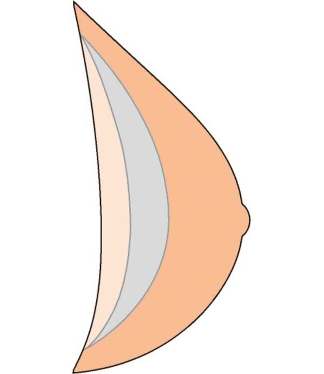 MMC Natura Light Prothese 1S - Huid