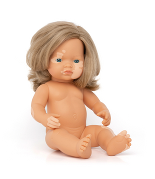 Pop Meisje Europees met Vitiligo (38 cm)