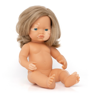 Miniland Pop Meisje Europees met Vitiligo (38 cm)
