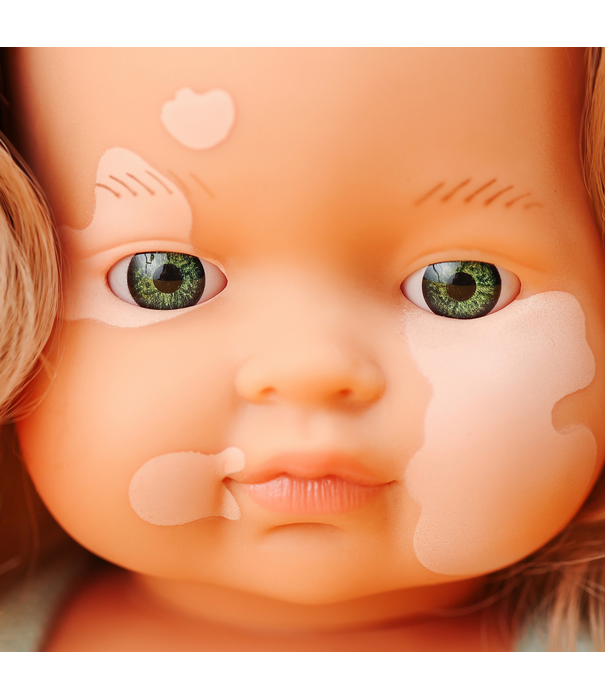 Miniland Miniland - Pop Meisje Europees met Vitiligo (38 cm)