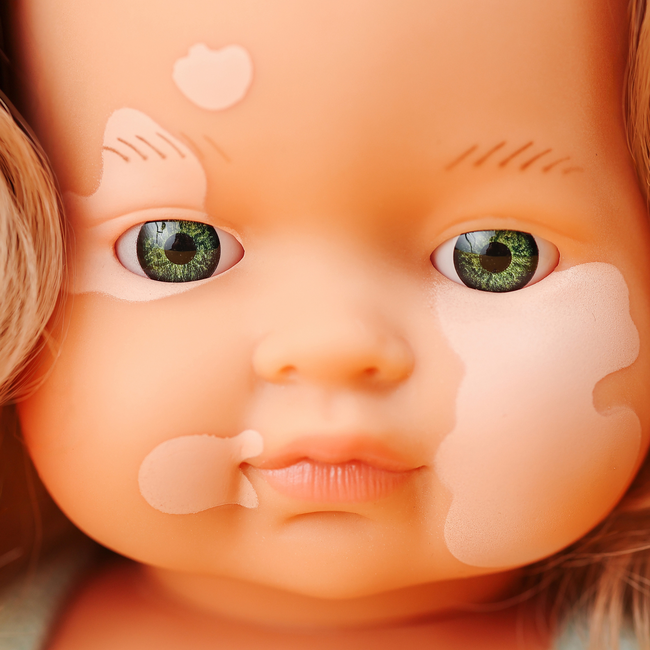 Miniland - Pop Meisje Europees met Vitiligo (38 cm)