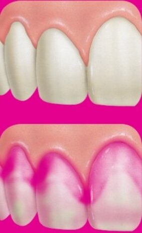 Red Cote Plakverklikkers - 12 stuks Red Cote Plakverklikkers - 12 stuks