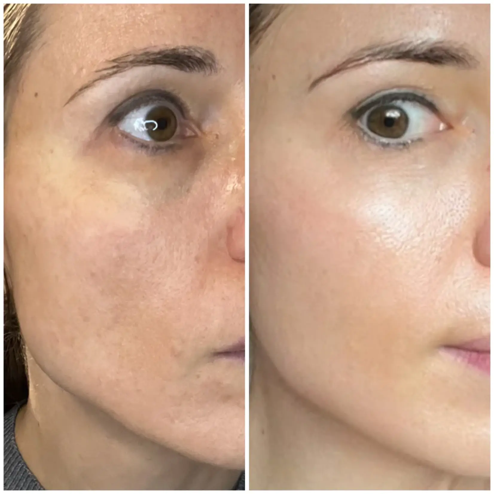DermaLab Hydrating Infusion: 1 single applicatie