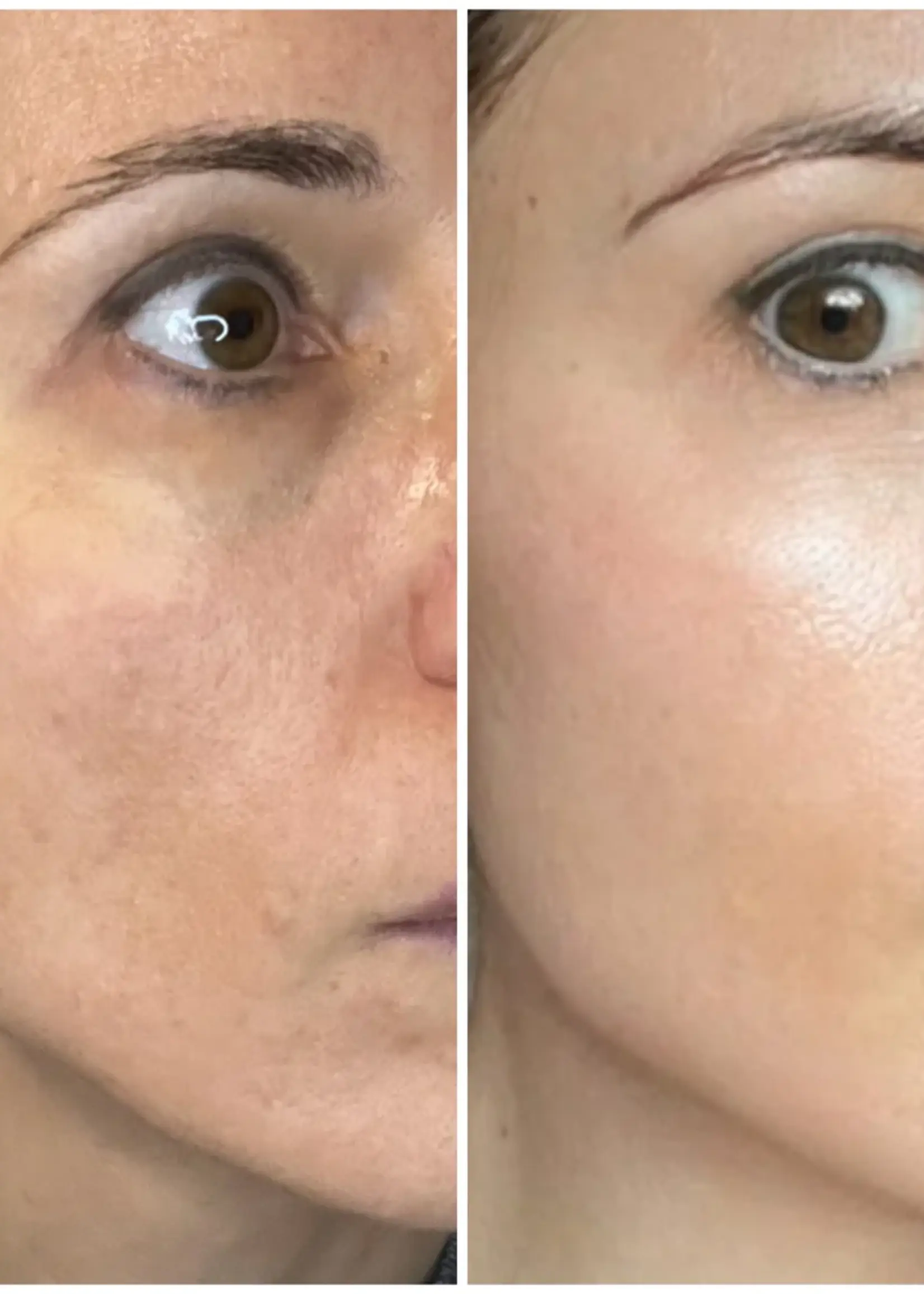 DermaLab Hydrating Infusion: 3 maanden plan
