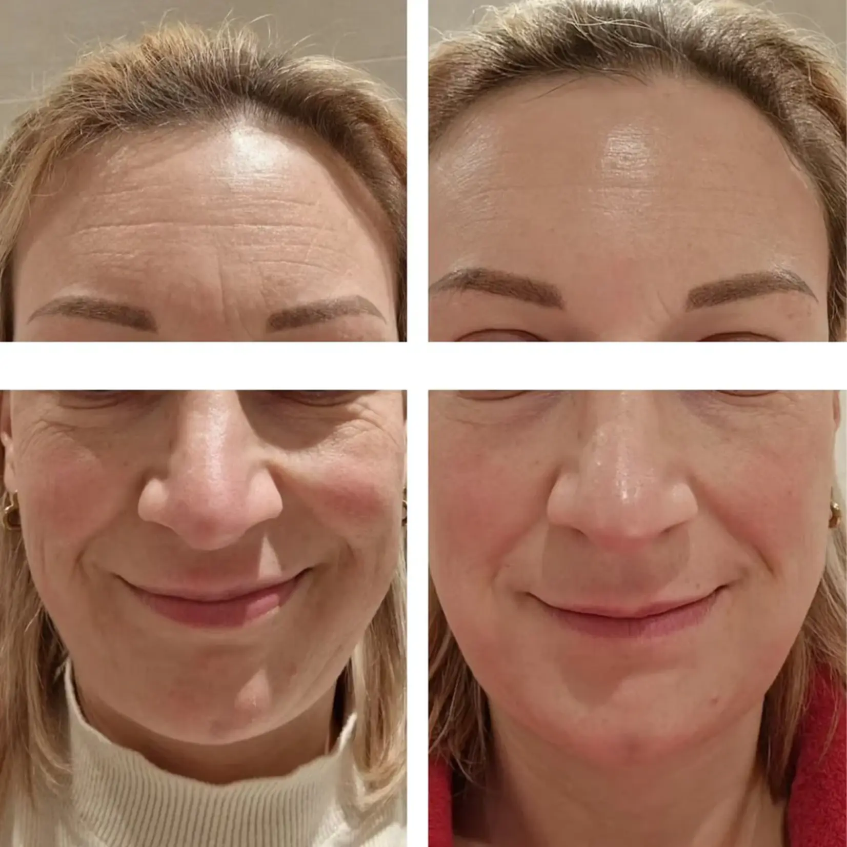 DermaLab Ultimate Summer Infusion