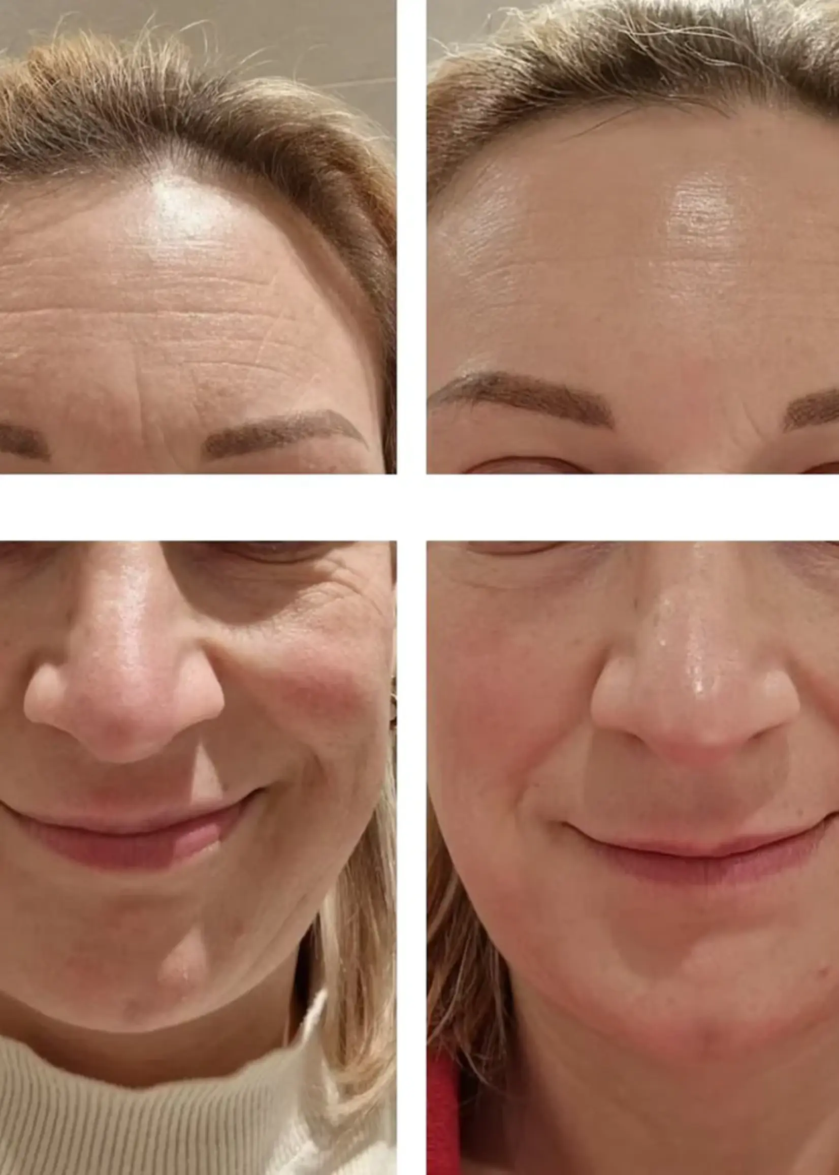 DermaLab Ultimate Summer Infusion