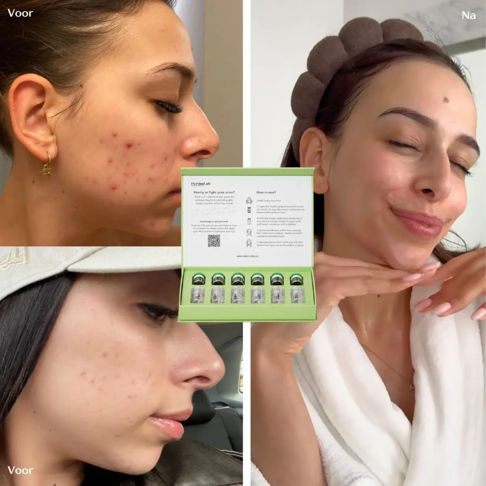 DermaLab Acne Infusion