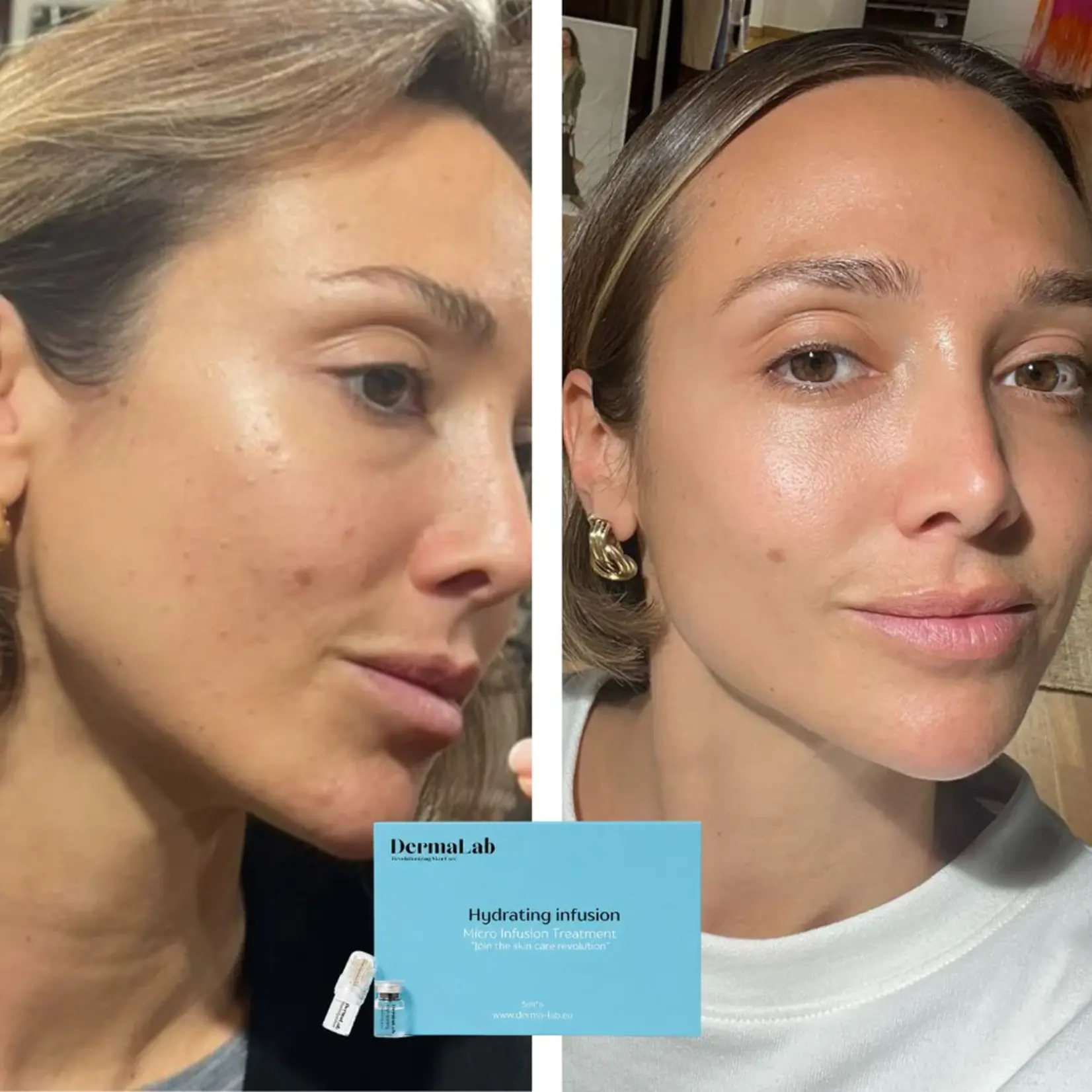 DermaLab Hydrating Infusion: 3 maanden plan