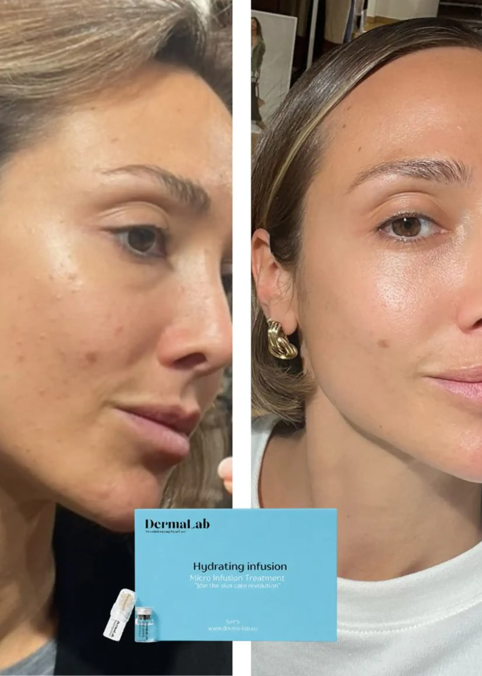 DermaLab Hydrating Infusion: 3 maanden plan