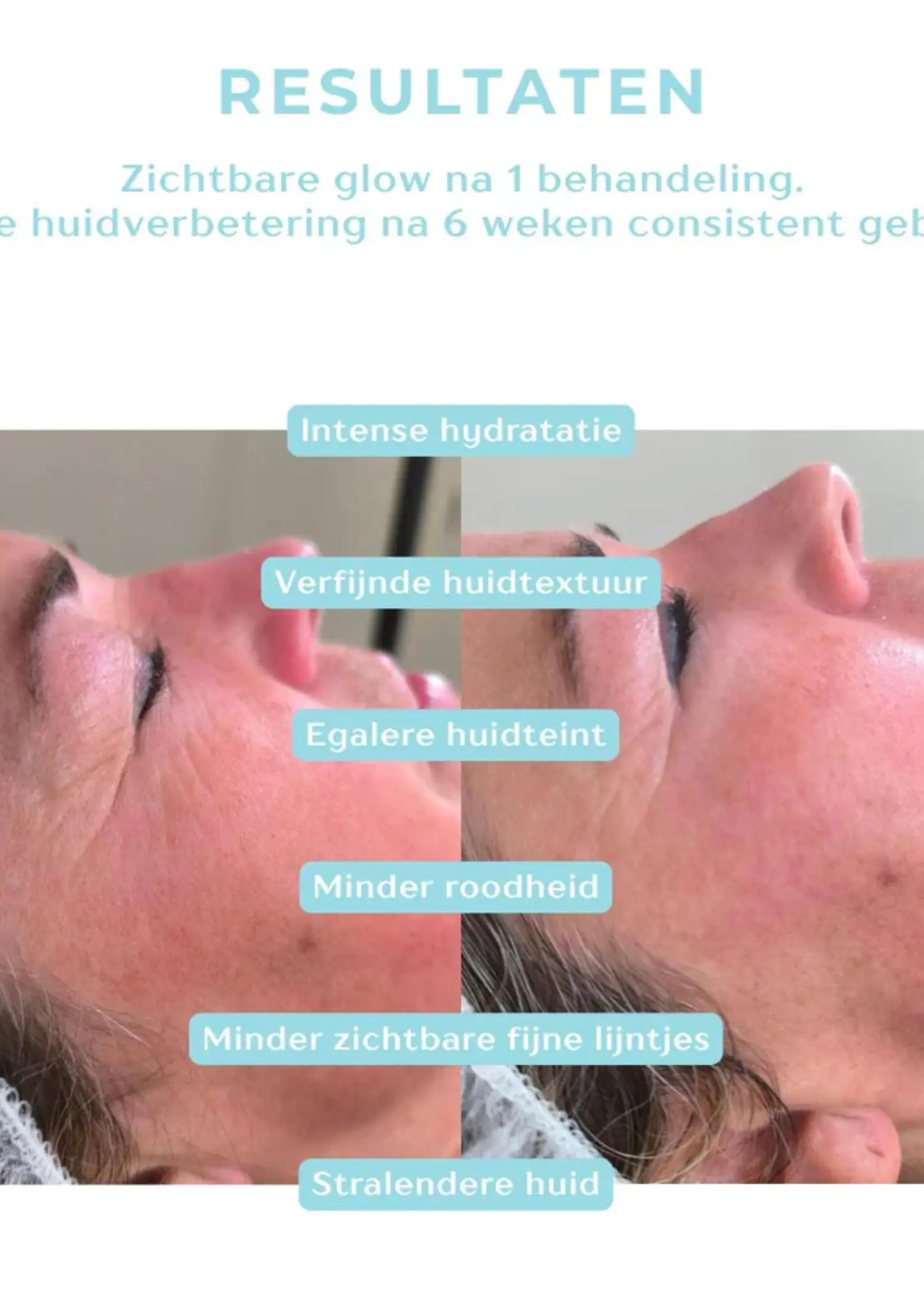 DermaLab Hydrating Infusion: 3 maanden plan