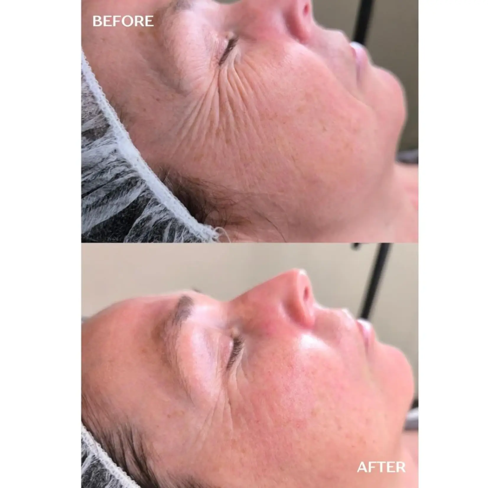 DermaLab Hydrating Infusion: 3 maanden plan