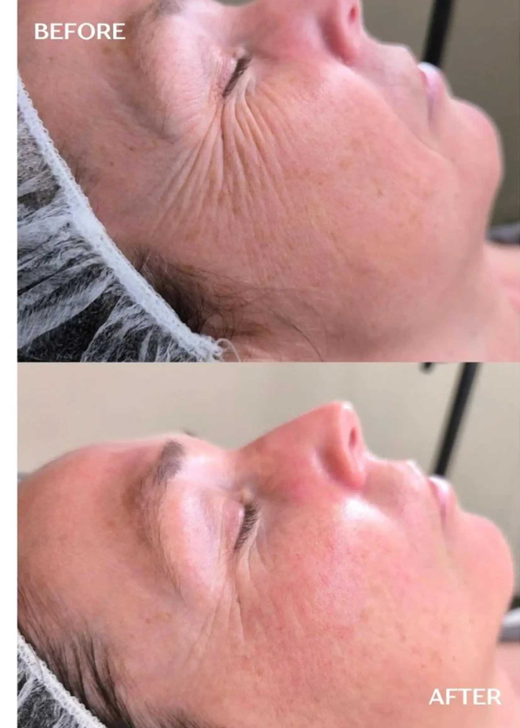 DermaLab Hydrating Infusion: 3 maanden plan