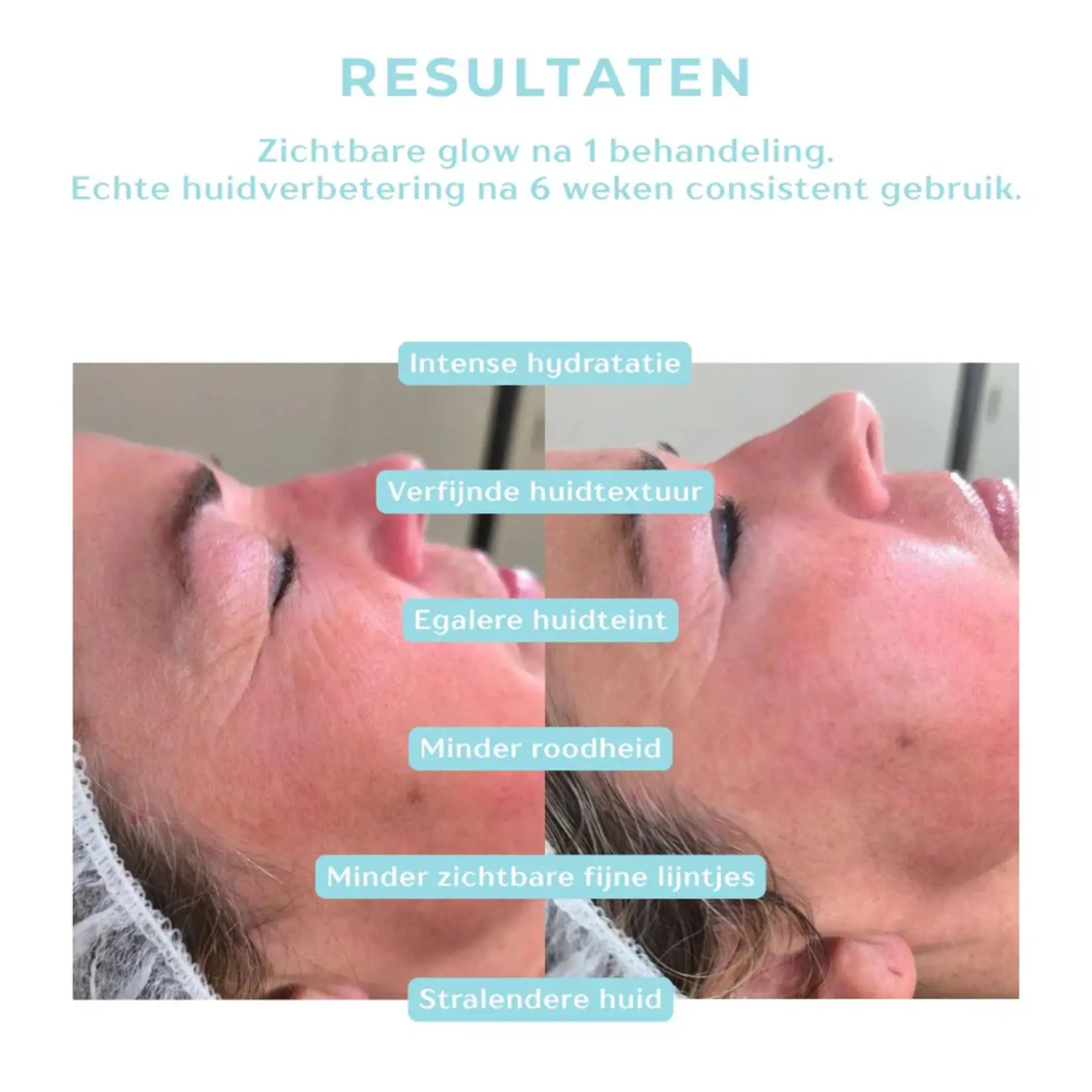 DermaLab Hydrating Infusion