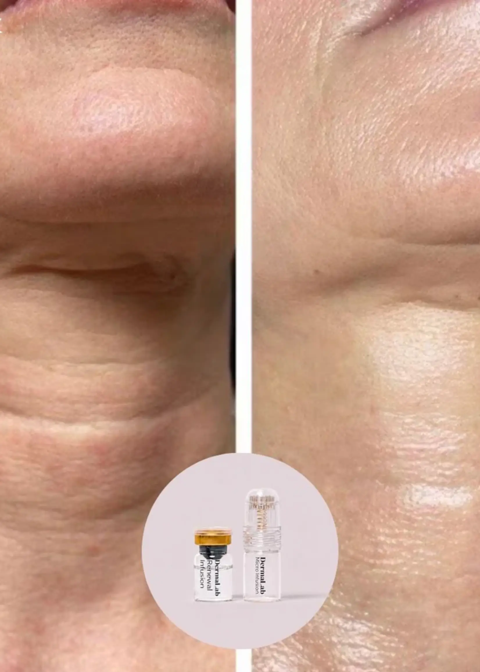 DermaLab Peptide Renewal Infusion