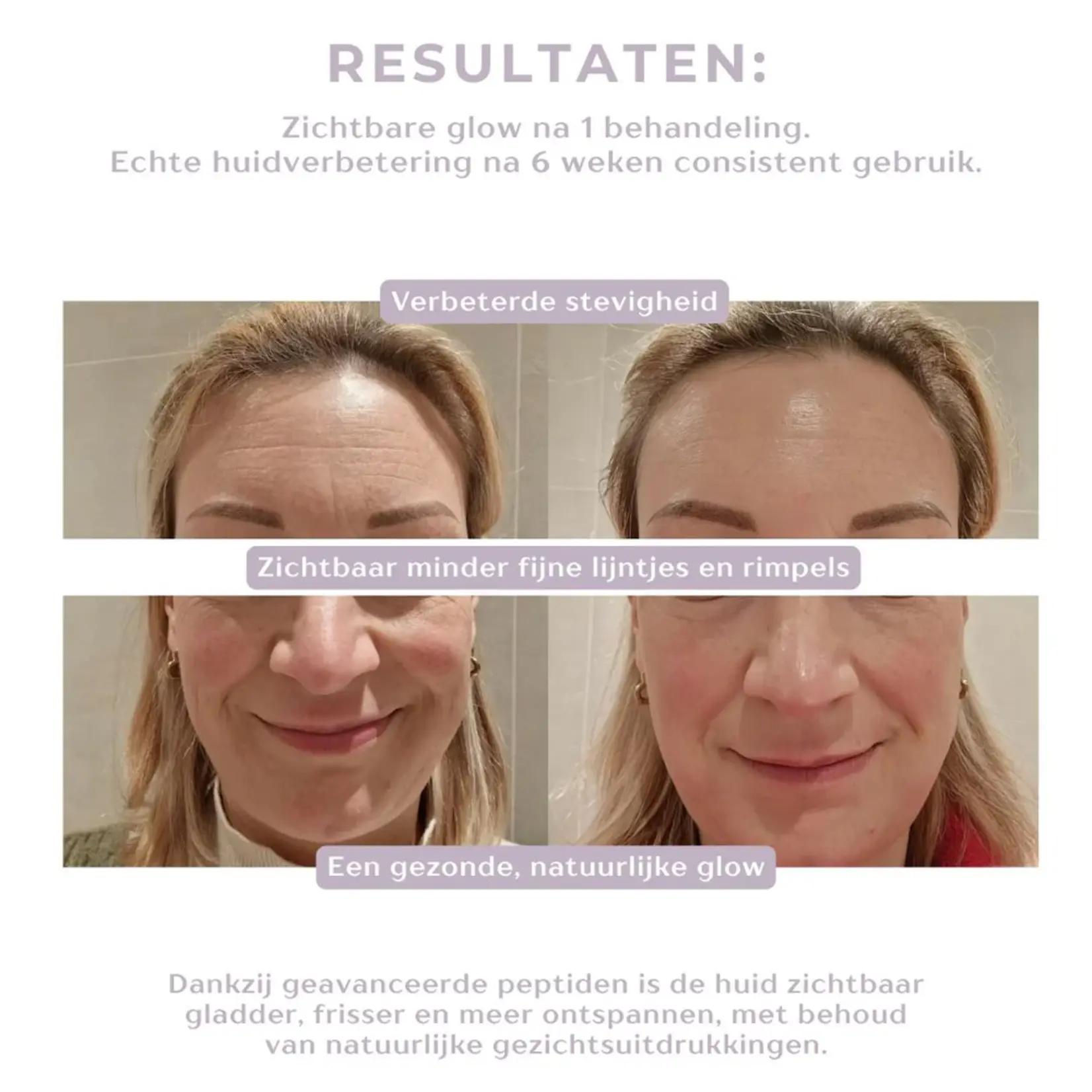 DermaLab Peptide Renewal Infusion