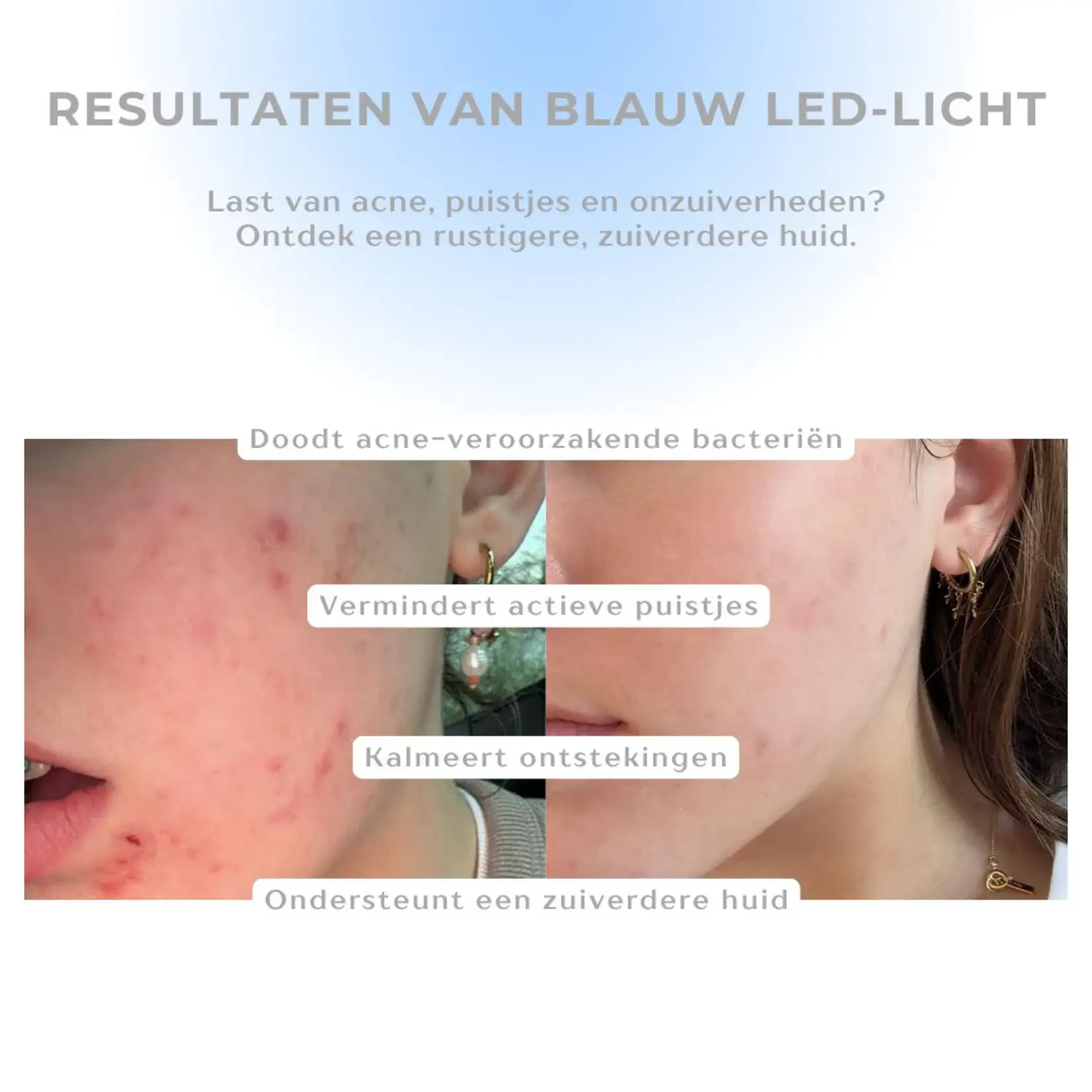 DermaLab Cell Core Pro LED Mask