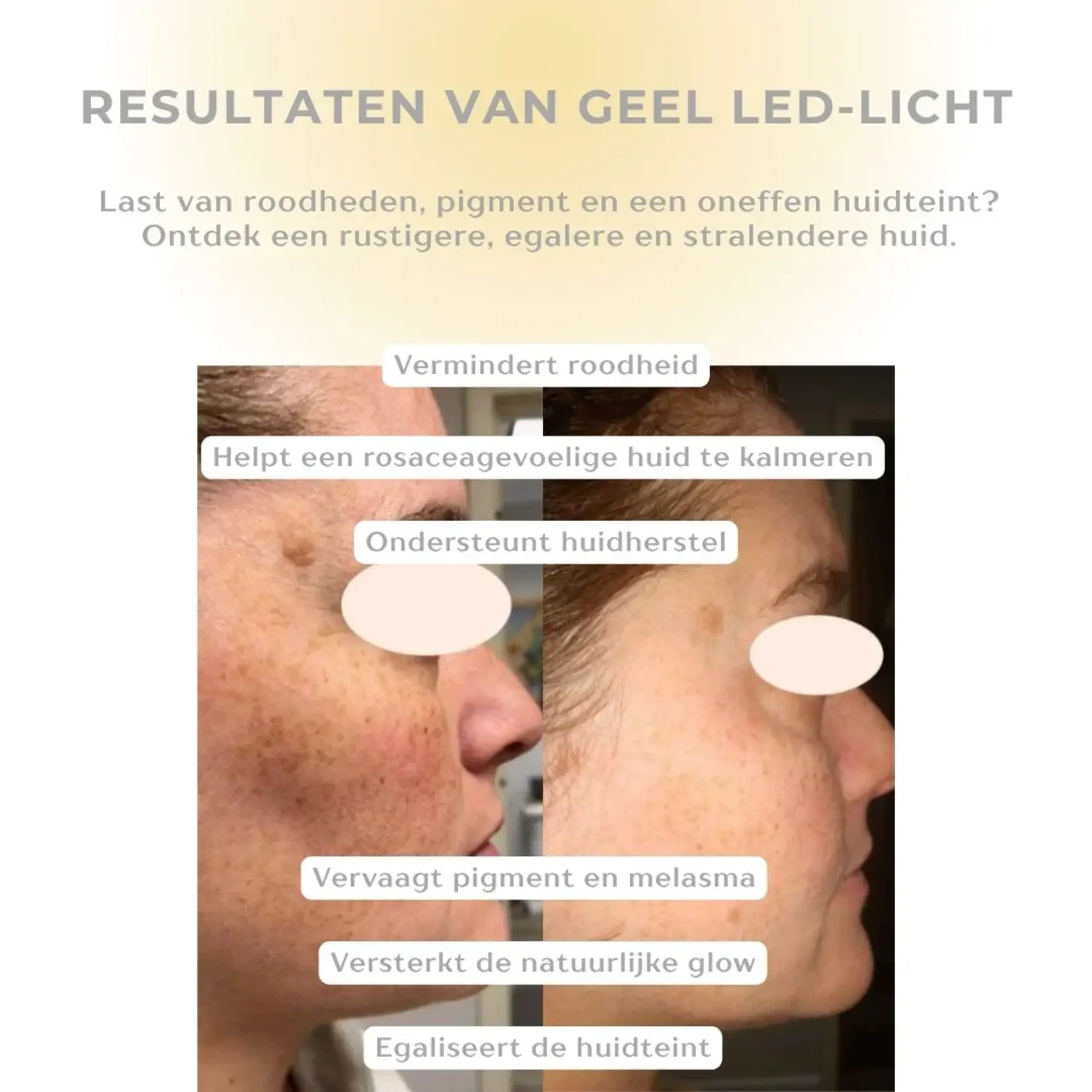 DermaLab Cell Core Pro LED Mask