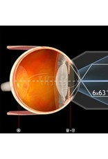 Volk Volk 6-spiegel Gonio lens No Flange No Fluid, handheld
