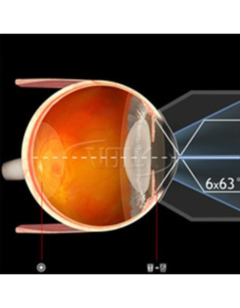 Volk Volk 6-spiegel Gonio lens No Flange No Fluid, handheld