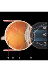 Volk Volk 3-spiegel gonio fundus lens No Flange/Fluid AR coating