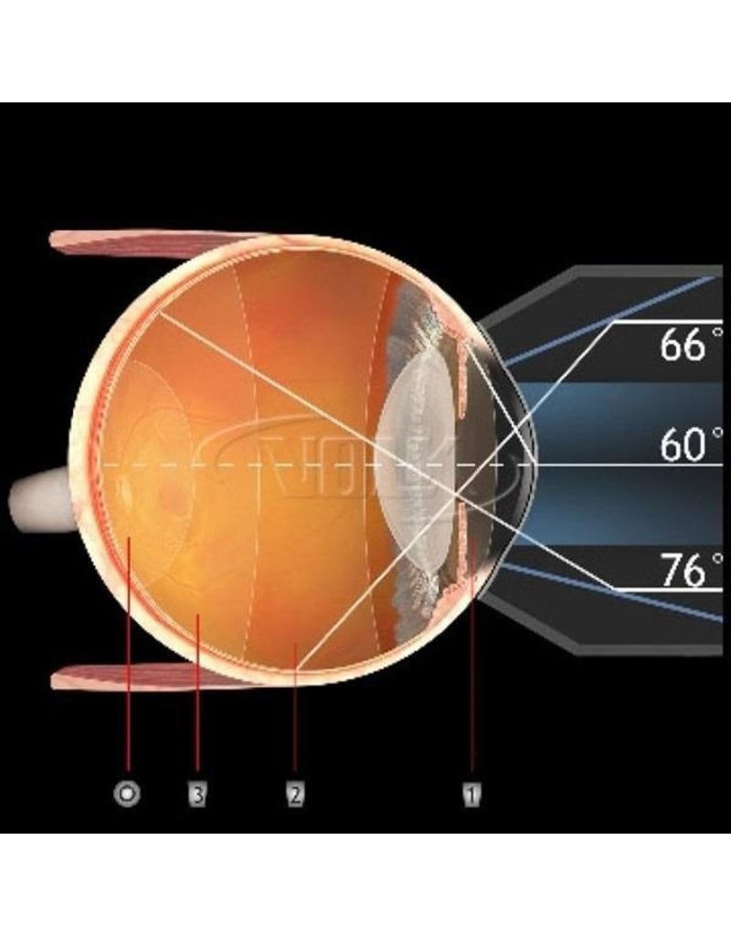 Volk 3-spiegel gonio fundus lens No Flange/Fluid AR coating