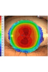 Medmont De meest verkochte topograaf in Nederland