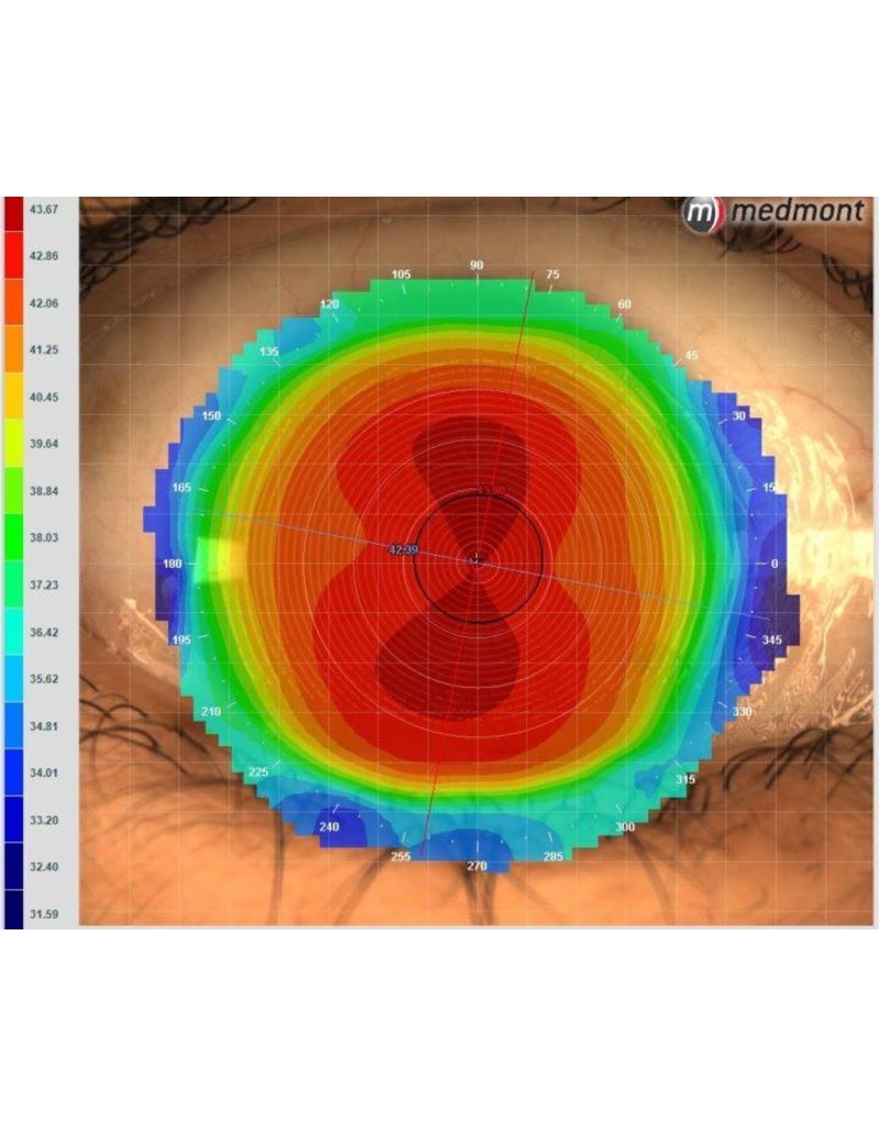 Medmont Aanbieding Medmont Meridia Classic corneatopograaf
