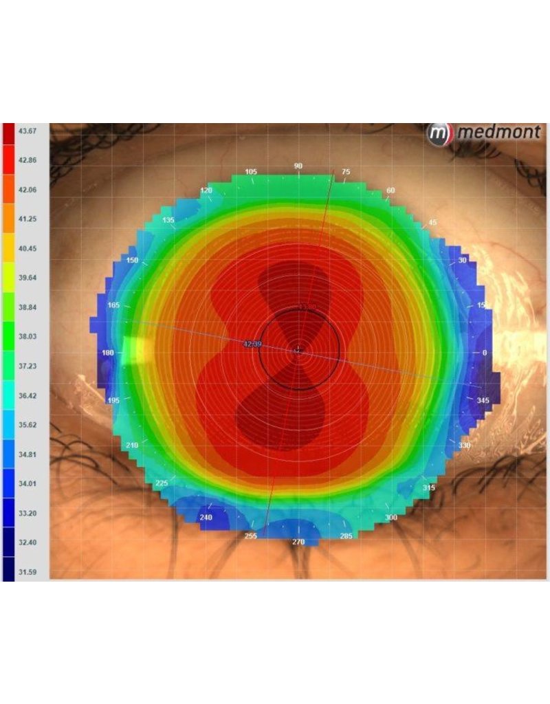 Medmont De meest verkochte topograaf in Nederland