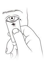 Ooglid everter Lidvue