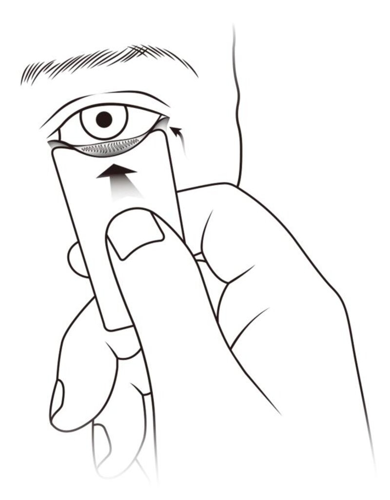 Ooglid everter Lidvue