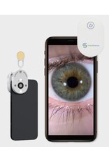 QuikVue Plus -Haarscherpe beelden van het voorste oogsegment in enkele seconden, direct vanaf je smartphone