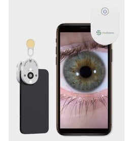 QuikVue Plus - haarscherpe beelden van het voorste oogsegment