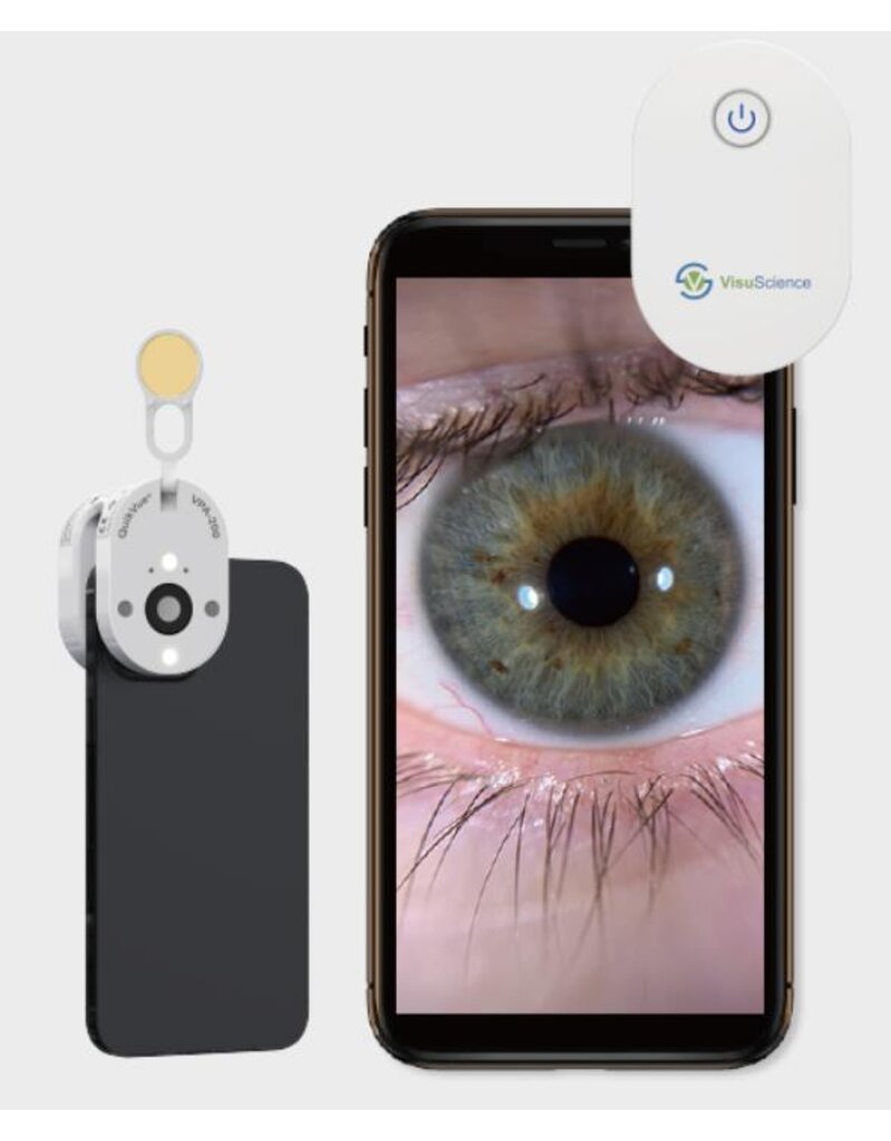 QuikVue Plus -Haarscherpe beelden van het voorste oogsegment in enkele seconden, direct vanaf je smartphone