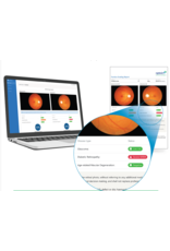 Assure +, slimme AI-software voor snelle en betrouwbare screening