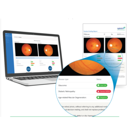 Assure +, slimme AI-software voor snelle en betrouwbare screening