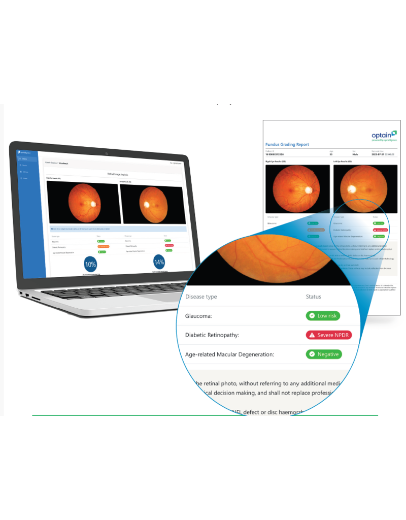 Assure +, slimme AI-software voor snelle en betrouwbare screening