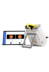 EyeVinci EyeVinci funduscamera met Assure + slimme AI-software