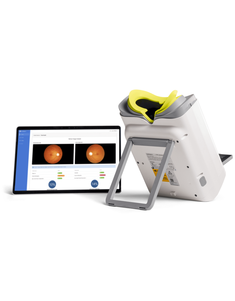 EyeVinci EyeVinci funduscamera met Assure + slimme AI-software