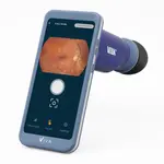 Volk Viva-Non Mydriatic fundus camera