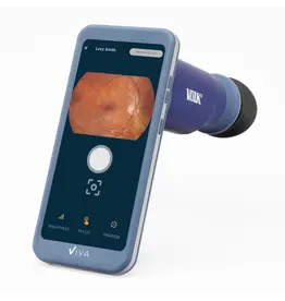 Volk Volk Viva-Non Mydriatic fundus camera