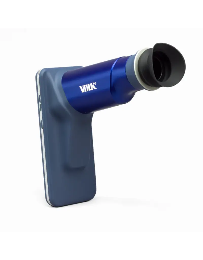 Volk Volk Viva-Non Mydriatic fundus camera