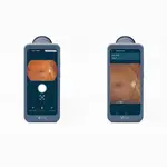 Volk Viva-Non Mydriatic fundus camera